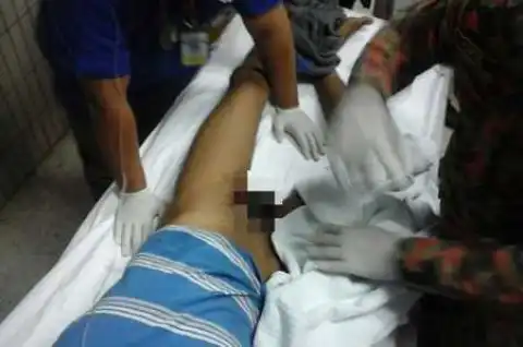 Horror! Man in Serious Agony for 12 Hours After Getting His P*nis Stuck In a Ring (Photo)